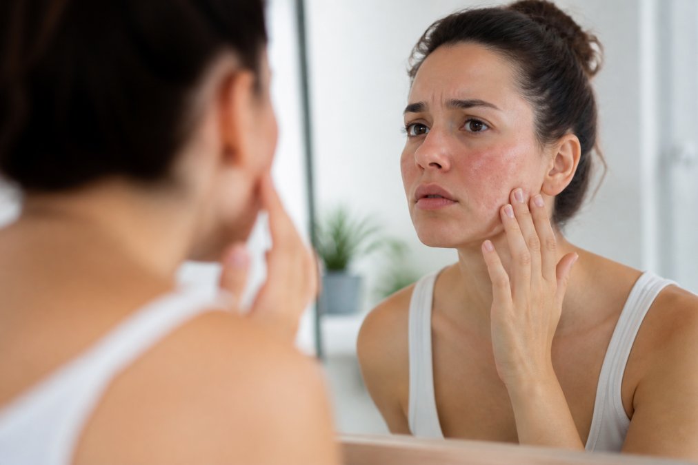 How to Fix Skin Barrier Damage: A Step-by-Step Guide
